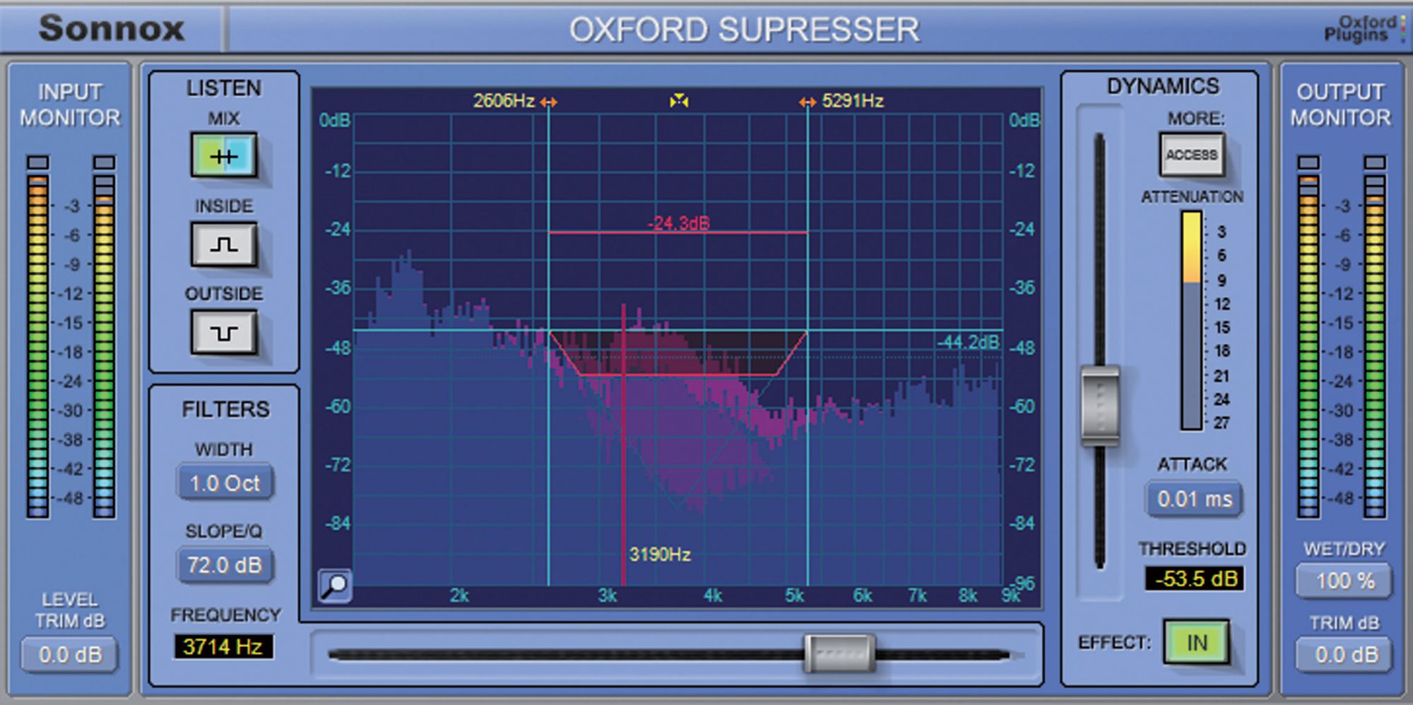 Oxford SuprEsser by Sonnox (Plugin Review)